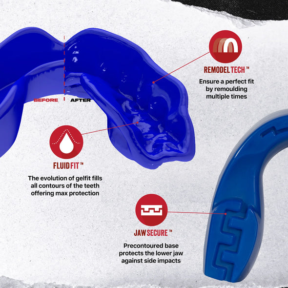 Blue mouthguard with features labeled on a white background
