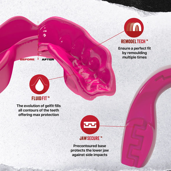 Pink mouthguard with features labeled on a white background