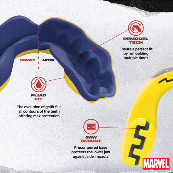 Teeth guard with Marvel branding, showing 'Before' and 'After' design on a textured white background.